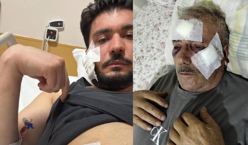 Muşta ile darbettiği iddia edilen taraftan açıklama geldi