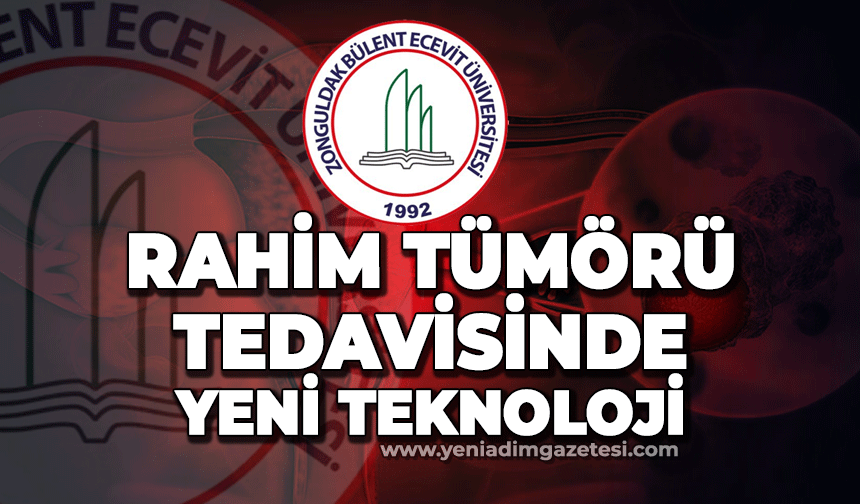 BEÜ'de Rahim tümörü tedavisin için üst düzey teknoloji kullanılacak