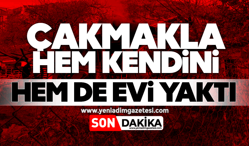 Çakmakla hem kendini hem de evi yaktı