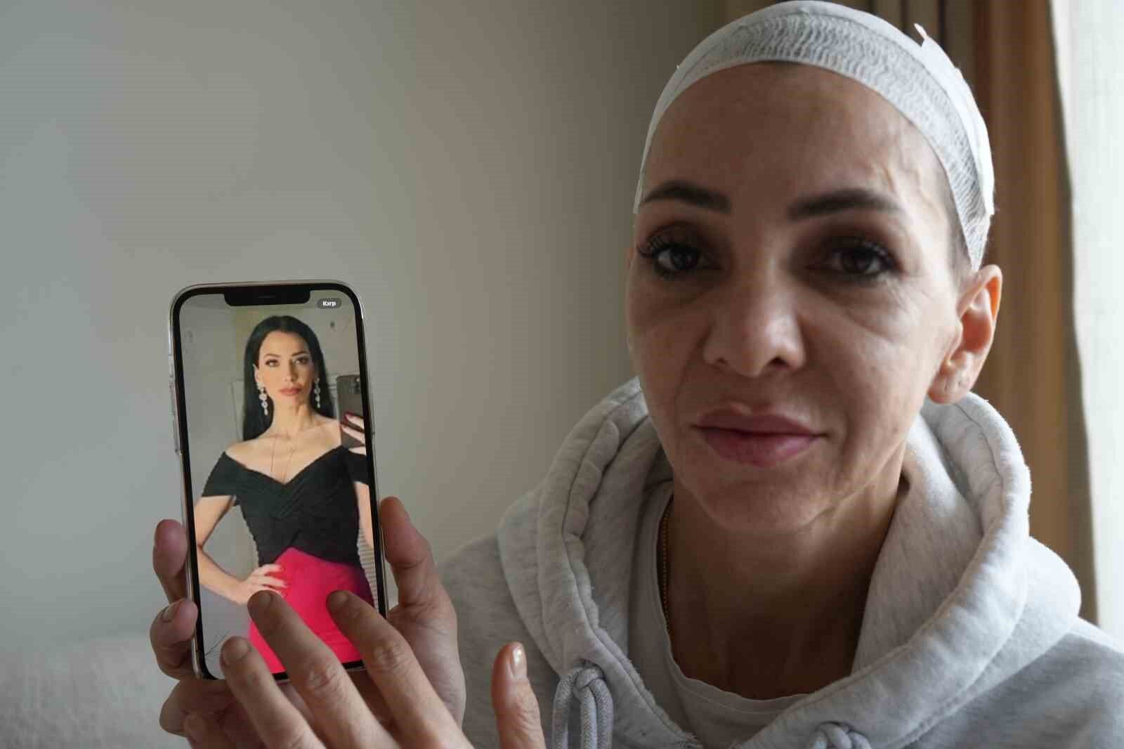 20260411 A W681518 01