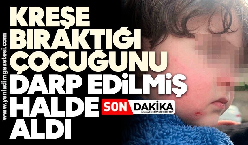 Kreşe bıraktığı çocuğunu darp edilmiş halde aldı
